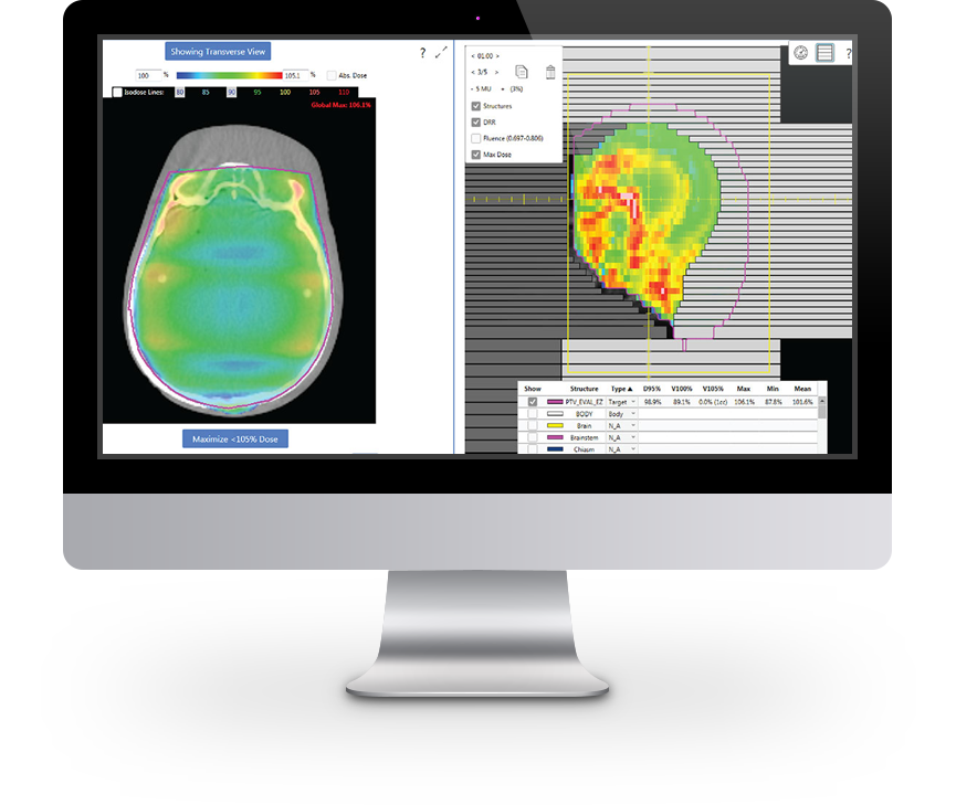 Qualitätssicherung intelligente, integrierte* automation für die Strahlentherapie