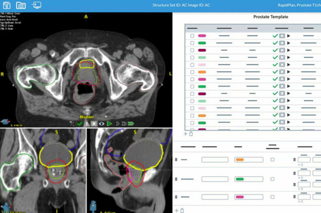AutoContour generiert schnelle, präzise, KI-gesteuerte Deep-Learning-Konturen