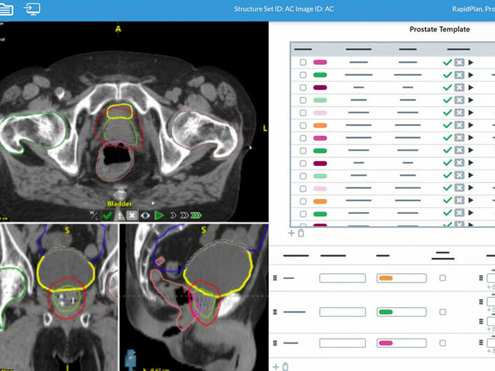 AutoContour generiert schnelle, präzise, KI-gesteuerte Deep-Learning-Konturen