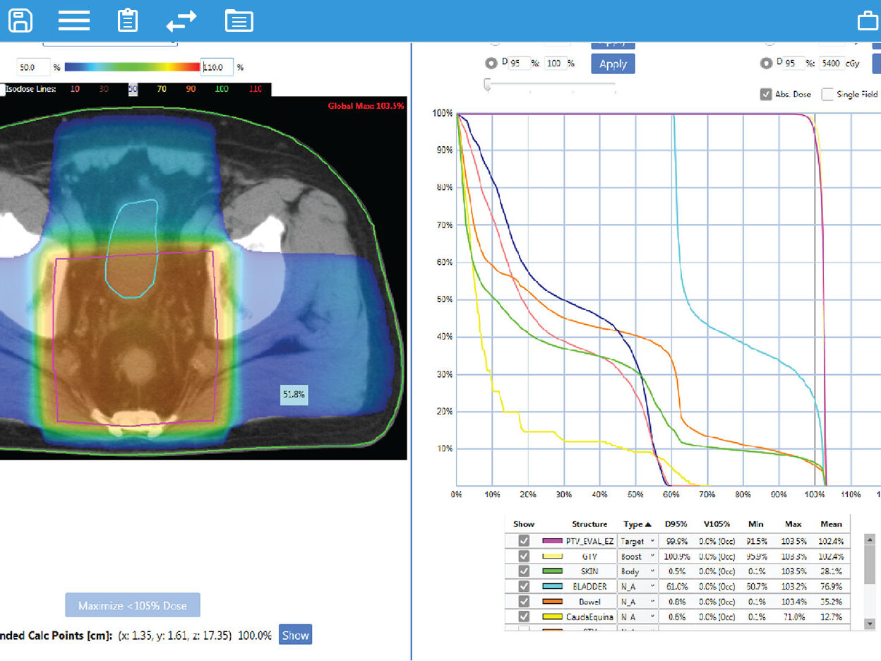 EZFluence Automatisierte 3D-Planung in der Strahlentherapie