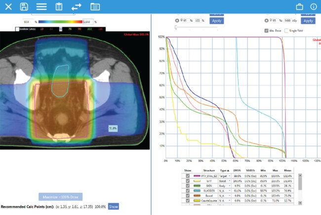 EZFluence Automatisierte 3D-Planung in der Strahlentherapie